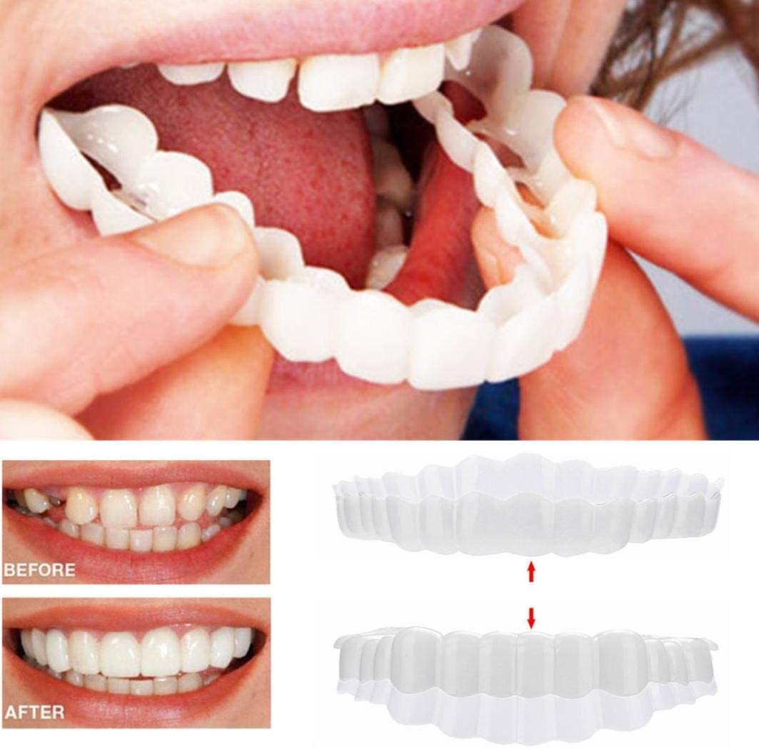 Radiant Smile Veneers – Complete Upper & Lower Set