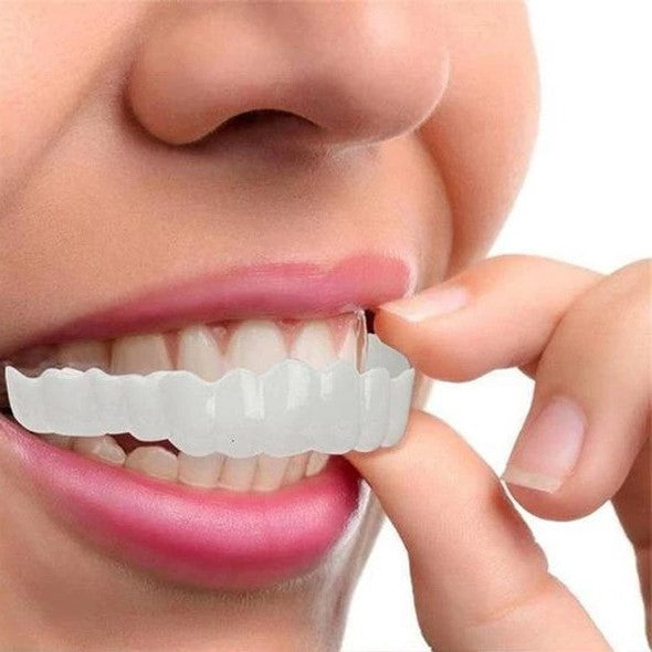 Radiant Smile Veneers – Complete Upper & Lower Set