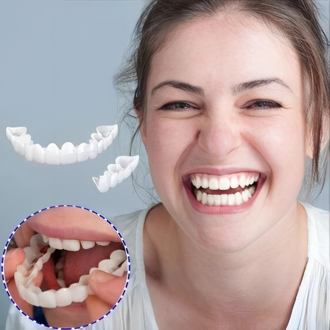 Radiant Smile Veneers – Complete Upper & Lower Set