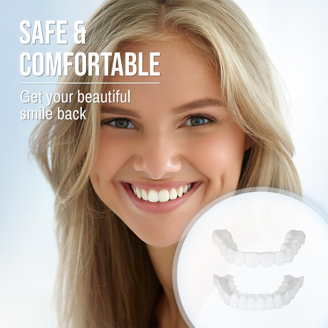 Radiant Smile Veneers – Complete Upper & Lower Set