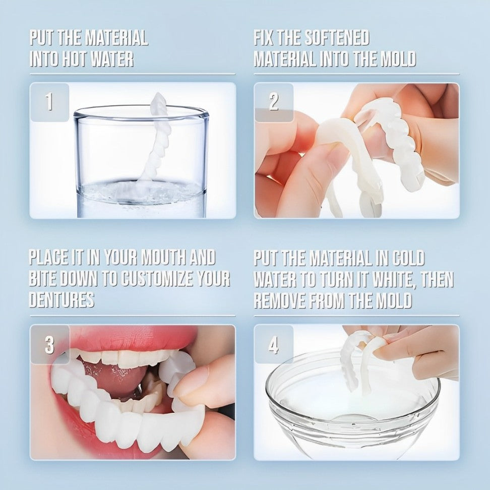 Radiant Smile Veneers – Complete Upper & Lower Set