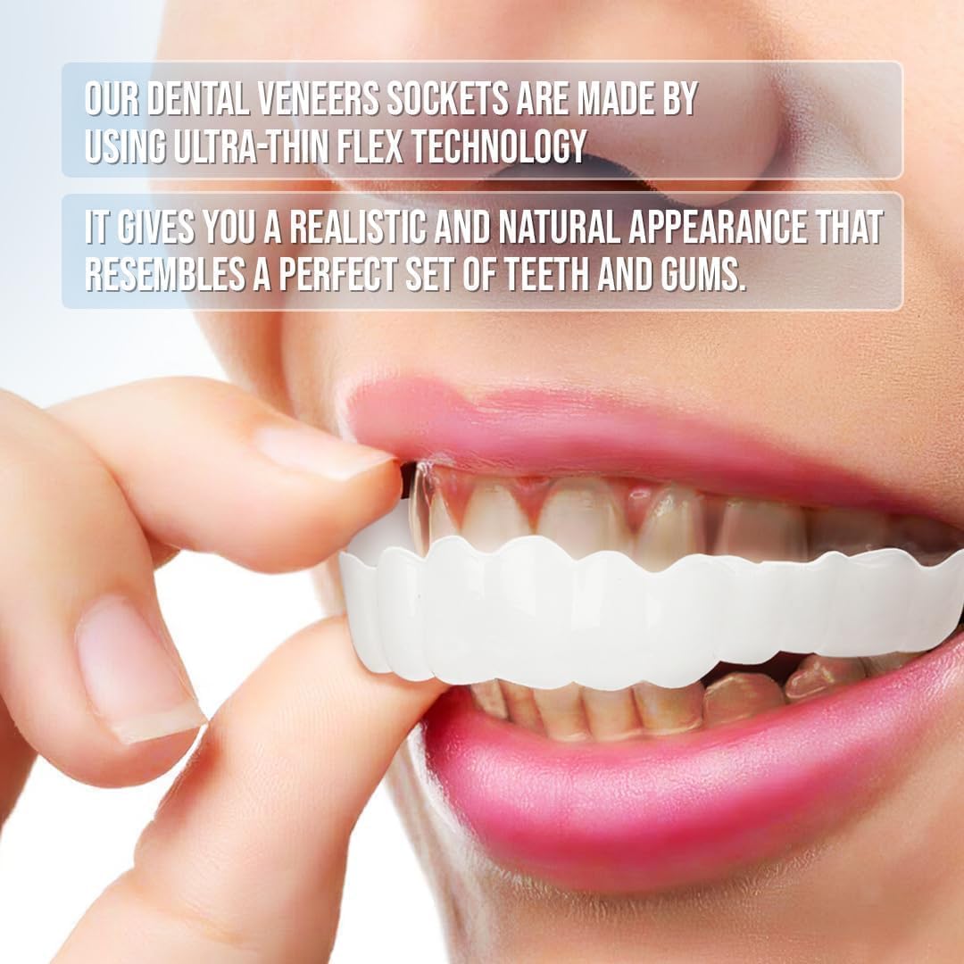 Radiant Smile Veneers – Complete Upper & Lower Set