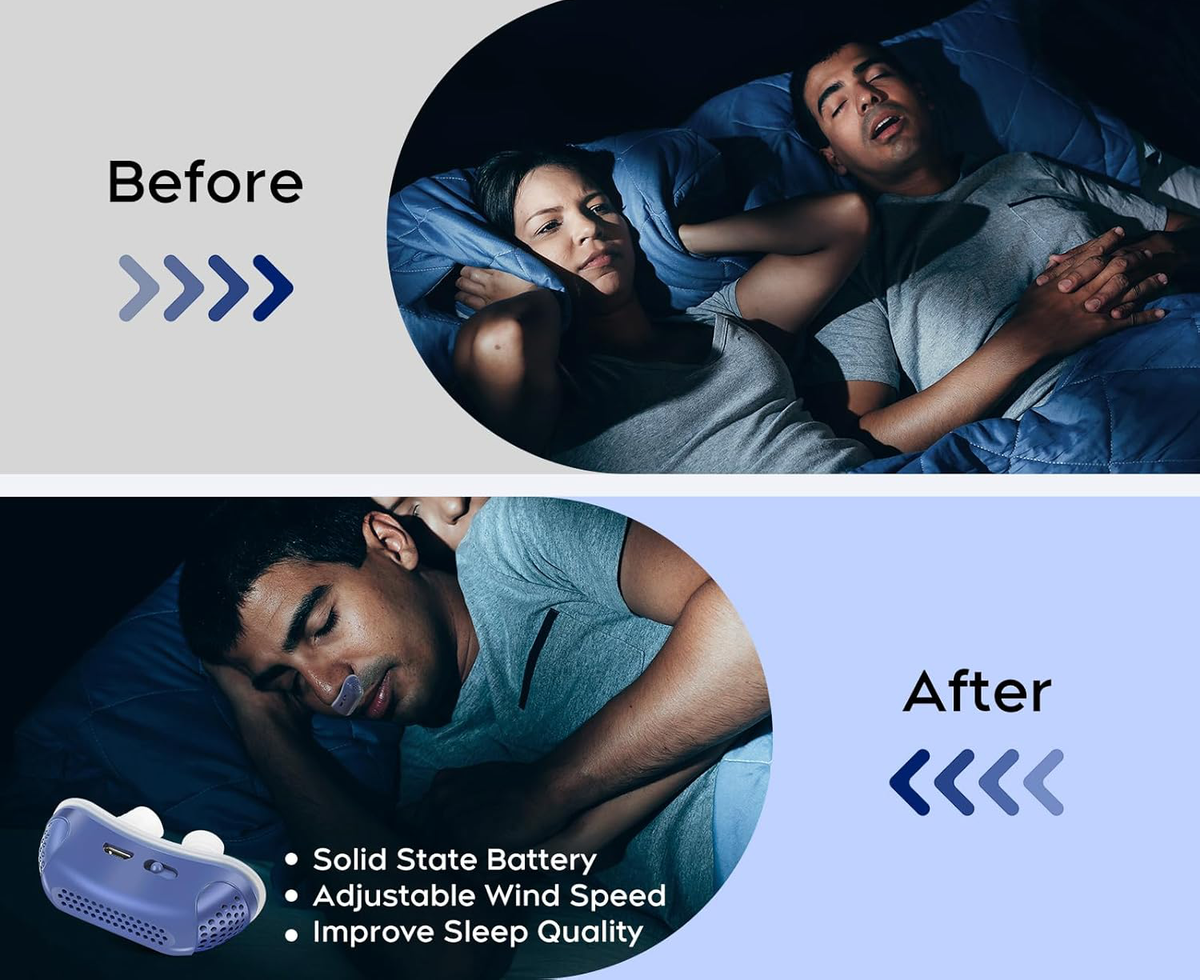 SnoreGuard Compact Nasal Device – Lightweight Travel Sleep Aid